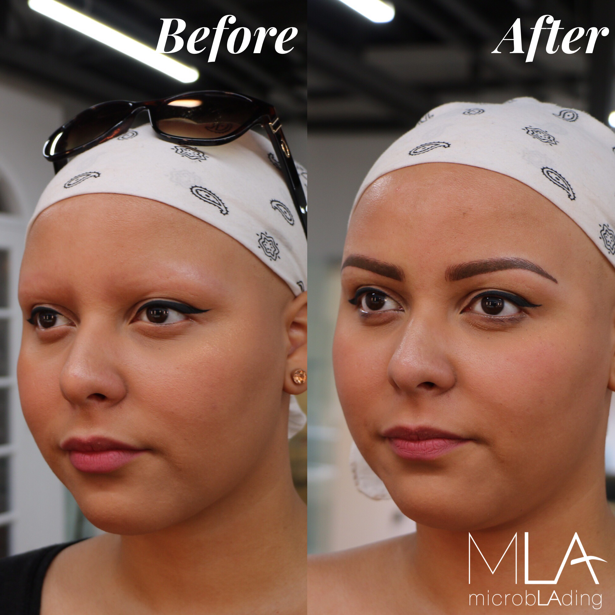 No Eyebrow Hair Microblading Before and After