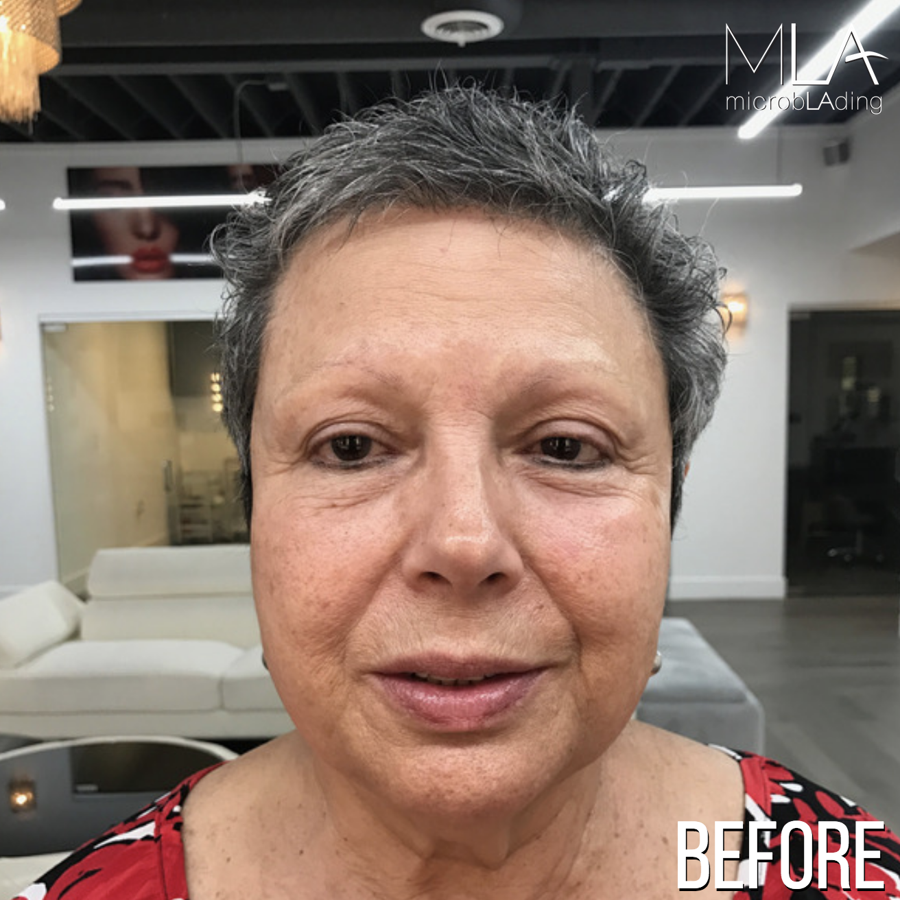 Microblading Cancer Surivor Before